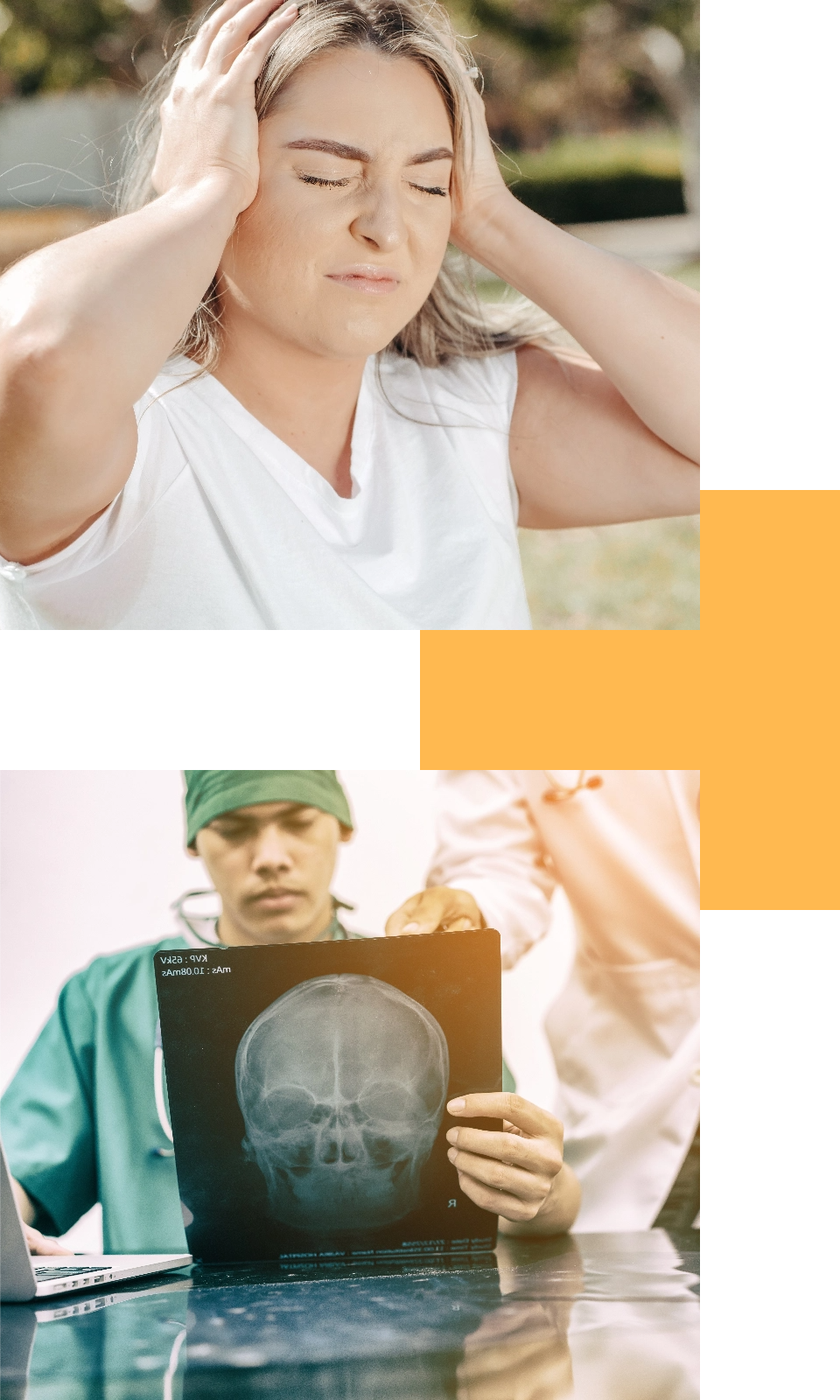 brain injuries image